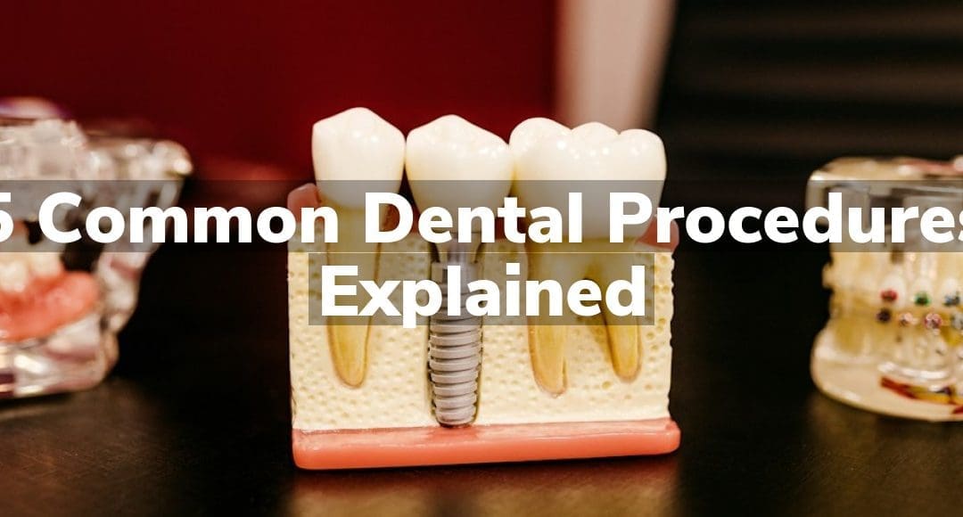 5 Common Dental Procedures Explained