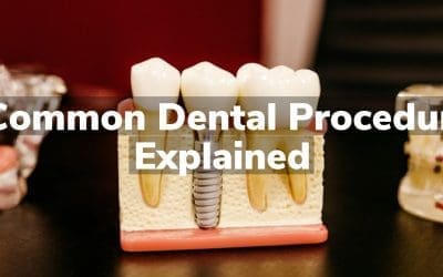 5 Common Dental Procedures Explained