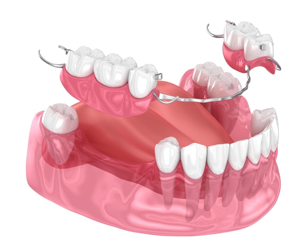 Corbin Dental in Bayside. Call 718-631-7051 for custom dentures.